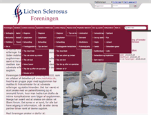 Tablet Screenshot of lichensclerosus.dk